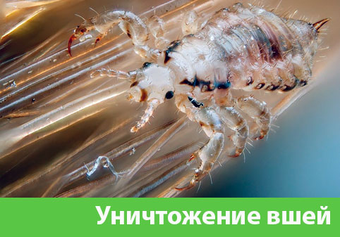 Уничтожение вшей в городе Орёл